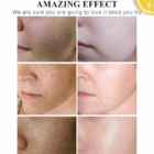 CREMA DE Suero de vitamina C Disaar Crema facial blanqueadora VC Reparadora Atenúa las pecas Elimina las manchas oscuras Melanina Aclara la piel Ácido hialurónico.