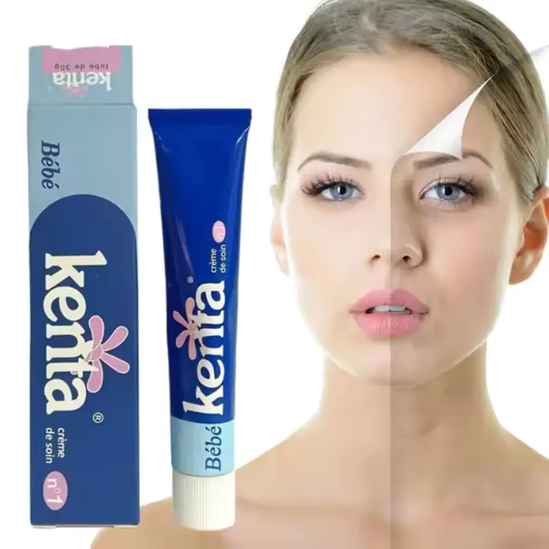 Crema calmante suave Kenta Bébé para piel sensible. Hidratación profunda. Antiacné. Protectora. Regeneradora.Calmante, Cuidado facial y corporal. 30GR Crema calmante suave Kenta Bébé para piel sensible. Hidratación profunda. Antiacné. Protectora. Regeneradora.Calmante, Cuidado facial y corporal. 30GR