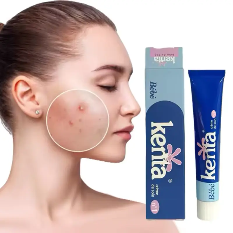 Crema calmante suave Kenta Bébé para piel sensible. Hidratación profunda. Antiacné. Protectora. Regeneradora.Calmante, Cuidado facial y corporal. 30GR