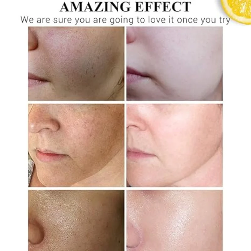 CREMA DE Suero de vitamina C Disaar Crema facial blanqueadora VC Reparadora Atenúa las pecas Elimina las manchas oscuras Melanina Aclara la piel Ácido hialurónico.